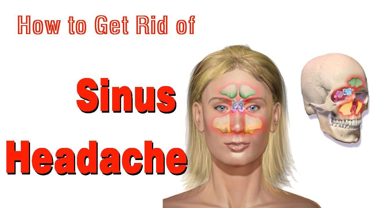 4 Effective and Easy to Use Remedies to Get Rid of a Sinus Headache