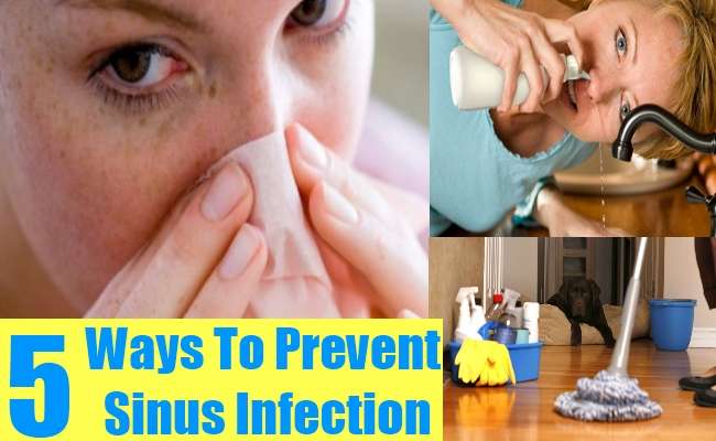 5 Effective Ways On How To Prevent Sinus Infection ...