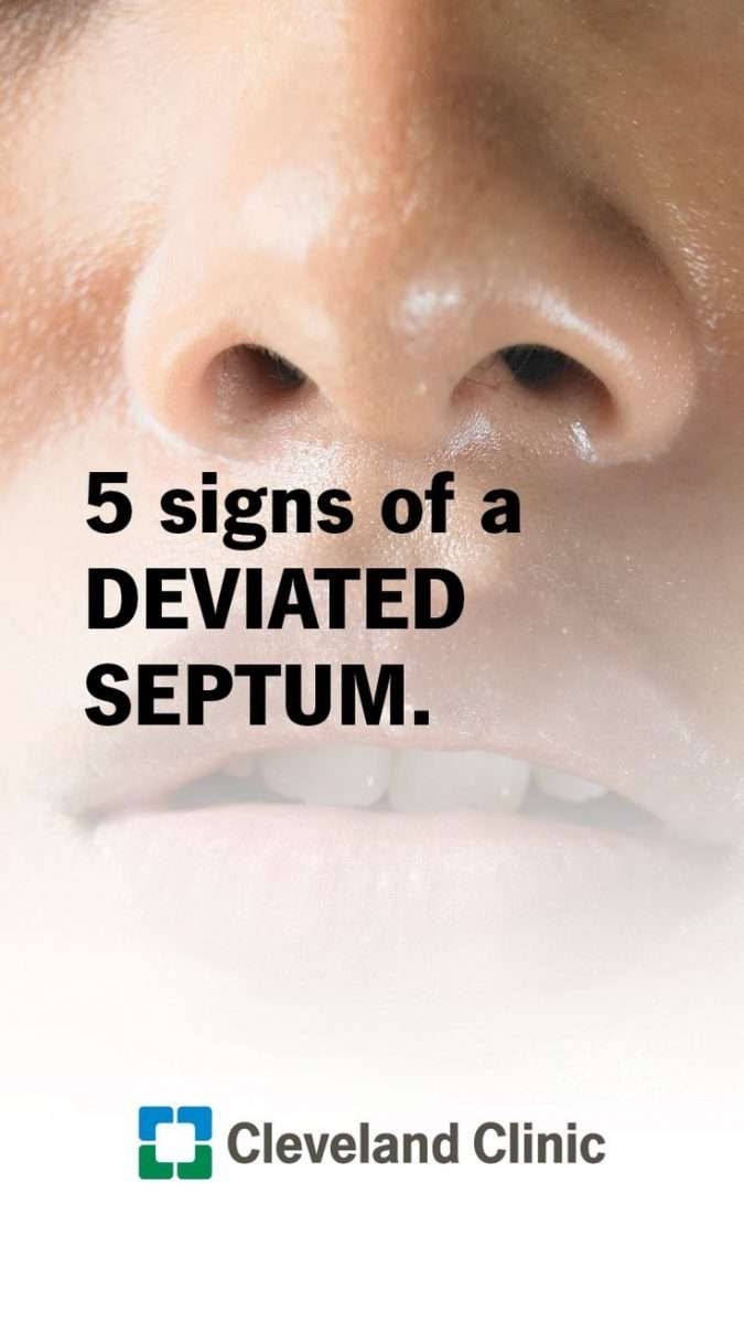 5 Signs of a Deviated Septum