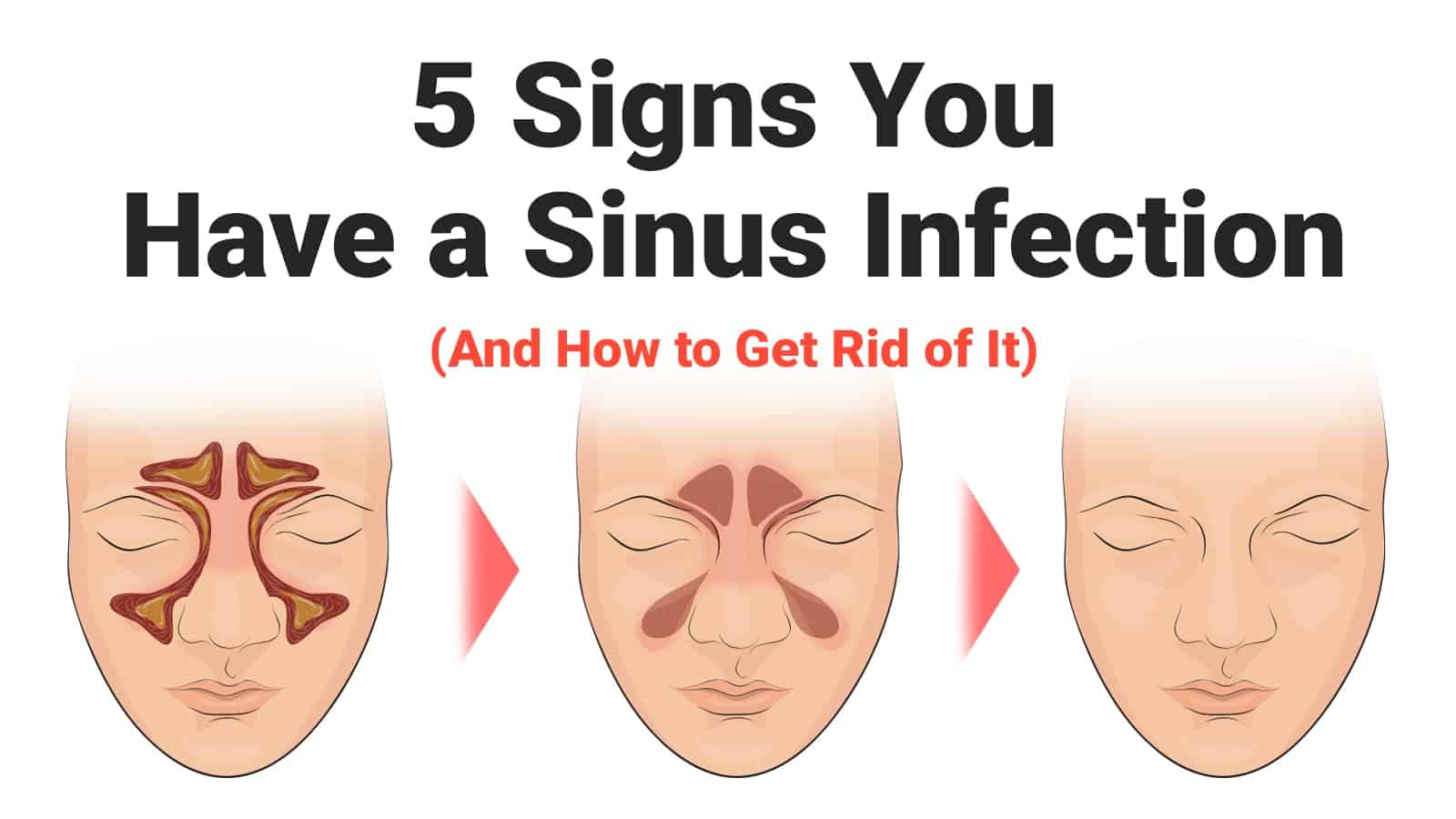 5 Signs You Have a Sinus Infection (And How to Get Rid of It)
