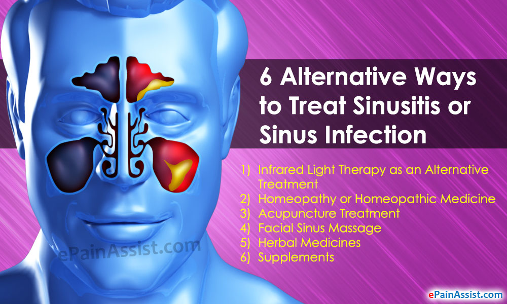 6 Alternative Ways to Treat Sinusitis or Sinus Infection