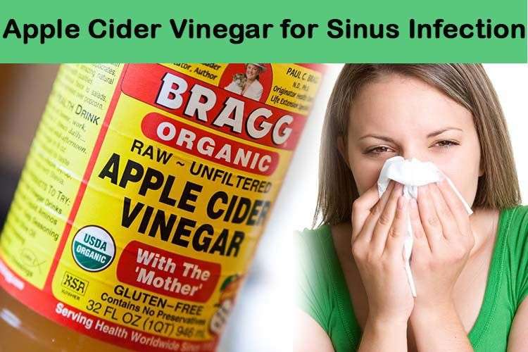 6 Ways To Use Apple Cider Vinegar For Sinus Infection.