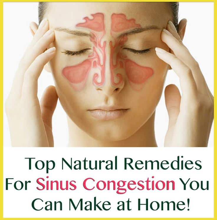 71 best images about DIY Home Remedies! on Pinterest