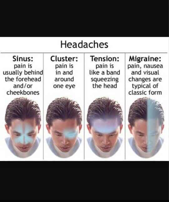 96 best Cluster headache help images on Pinterest
