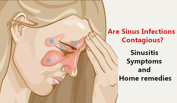 Are Sinus Infections Contagious? Sinusitis Symptoms and Home Remedies