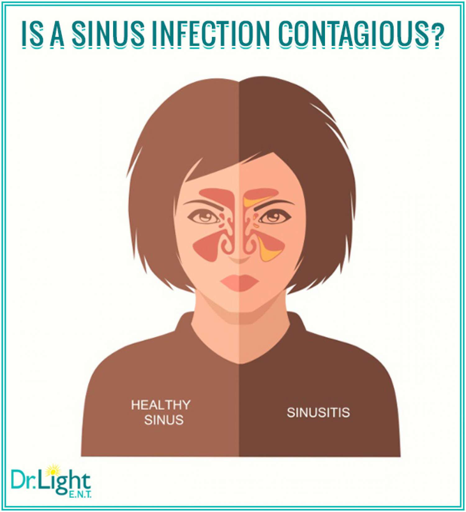Are Sinus Infections Contagious?