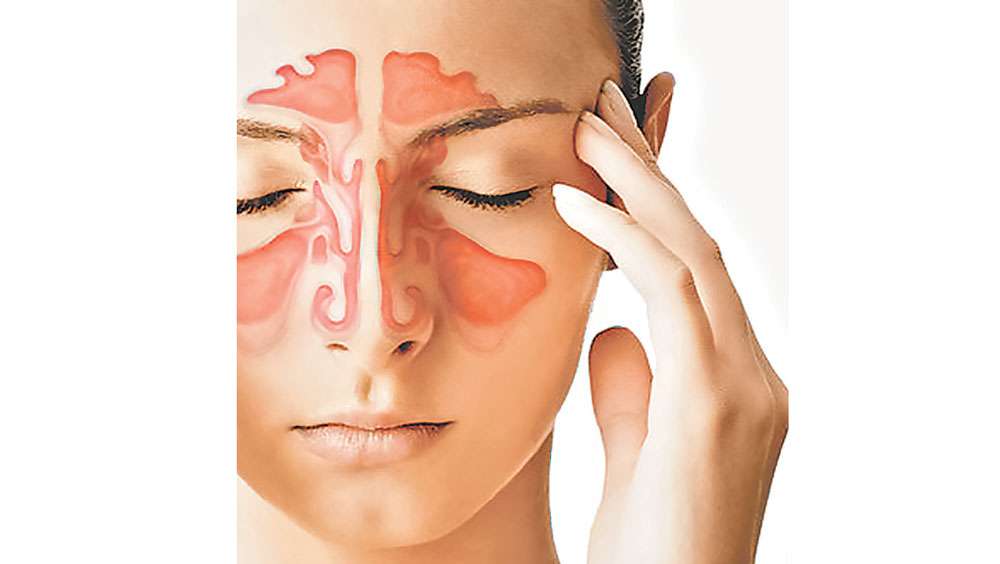 Ayurvedic Sinus Infection Treatment