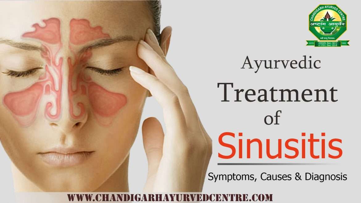 Ayurvedic Treatment for Sinusitis
