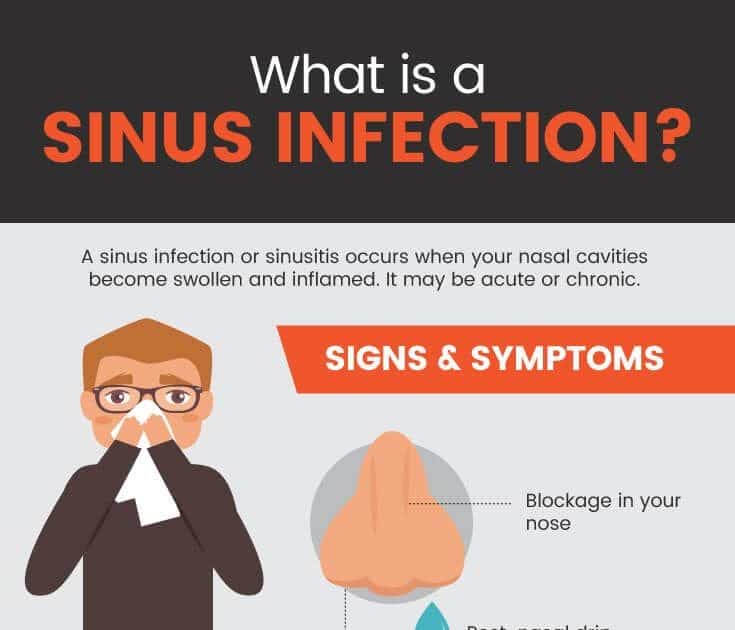 Can A Sinus Infection Be Treated Without Antibiotics