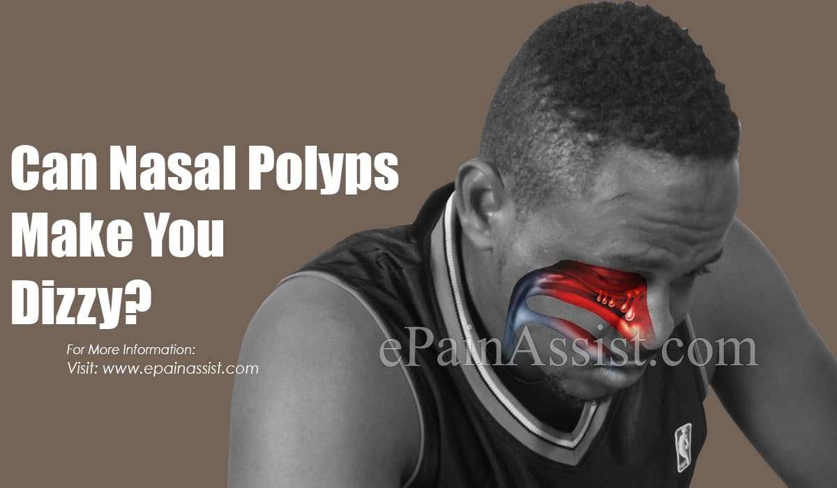 Can Nasal Polyps Make You Dizzy &  Can They Cause Fatigue?