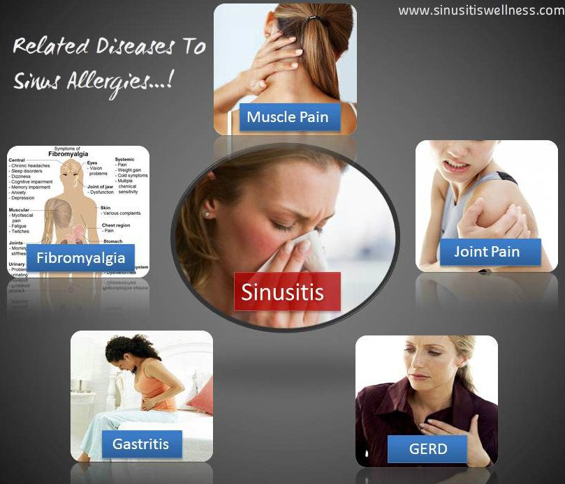 Can Sinus Cause Memory Loss