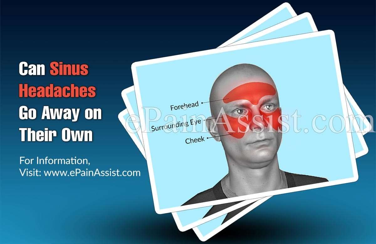 Can Sinus Headaches Go Away on Their Own, if Not, What Can ...