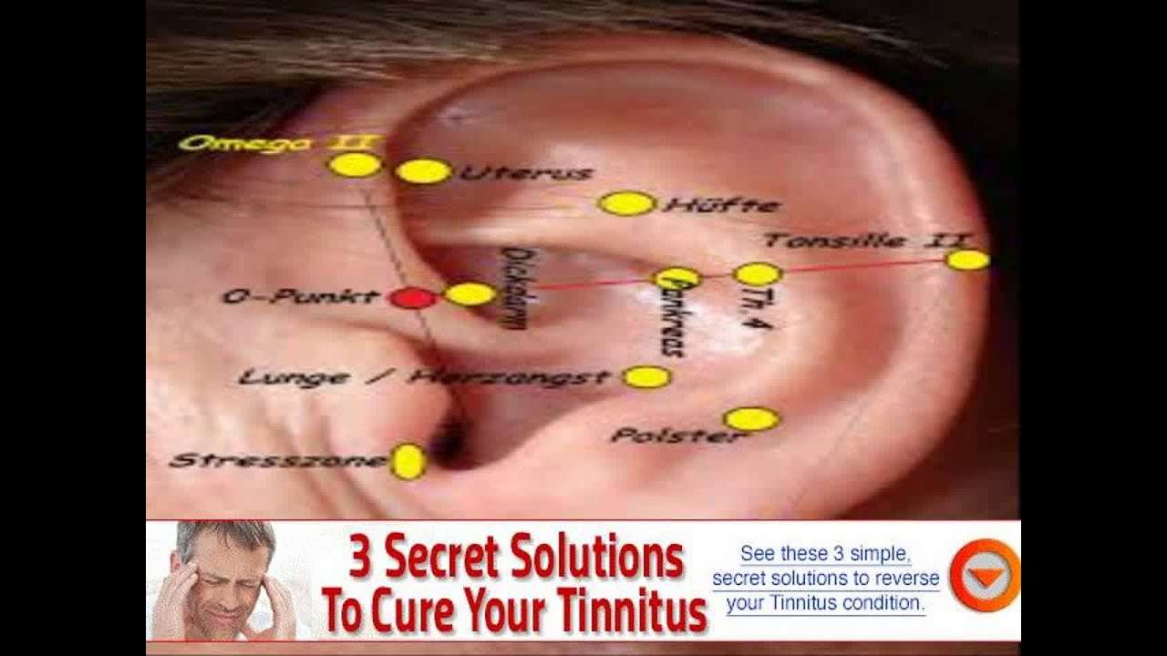 can sinus infection cause ringing in ears