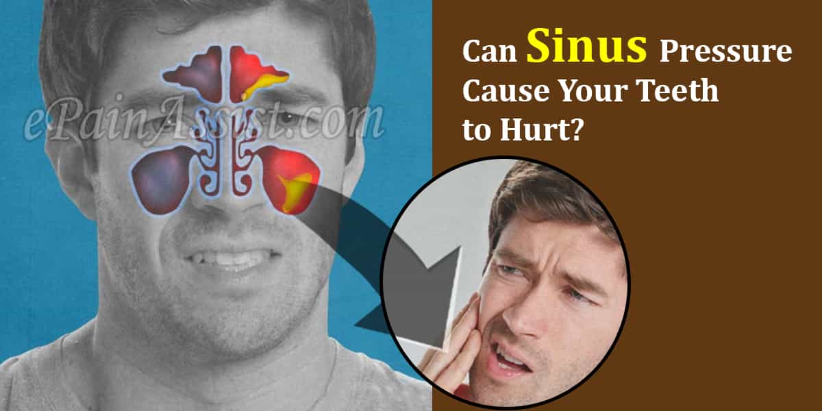Can Sinus Pressure Cause Your Teeth to Hurt?