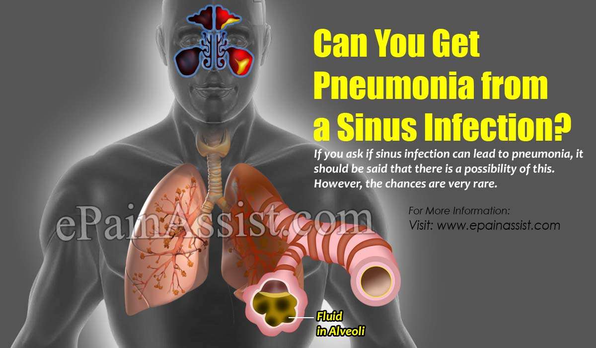 Can You Get Pneumonia from a Sinus Infection?