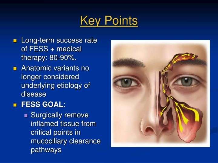 Concepts of Endoscopic Sinus Surgery: Causes of Failure ...