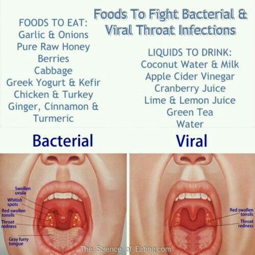 Differences between Bacterial vs Viral sore throat (infection) symptoms ...