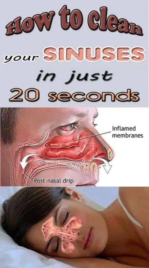 DIY How to Clear Your Sinuses in Seconds Using Nothing But Your Fingers ...