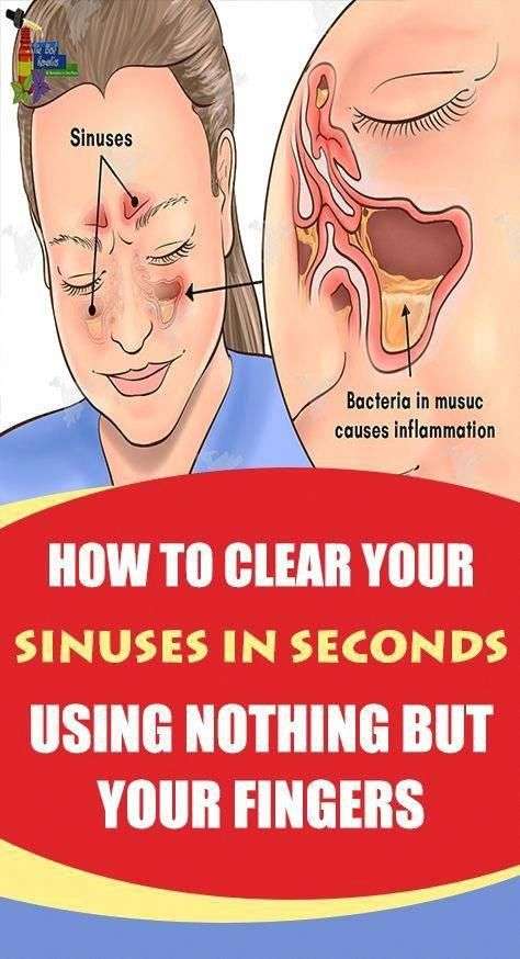 DIY: How to Clear Your Sinuses in Seconds Using Nothing ...