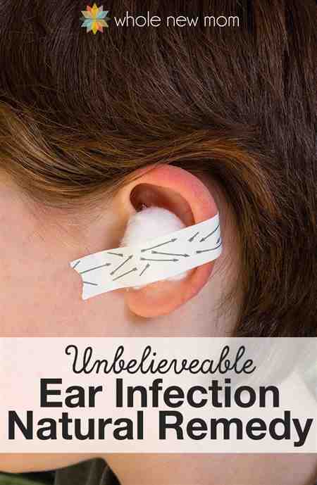 Ear Infection In Adults Without Pain Hear Infection Outer ...