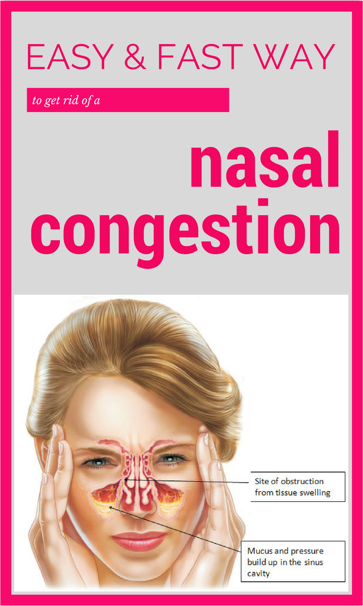 Easy &  Fast Way to Treat a Nasal Congestion