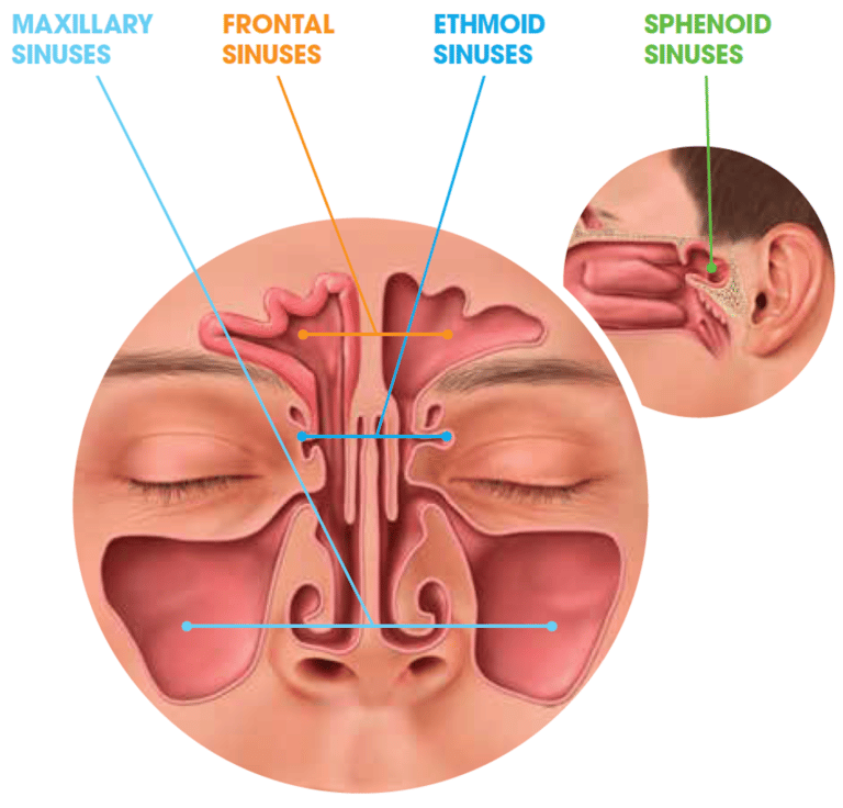 Everything You Need to Know About Sinusitis: Part 1