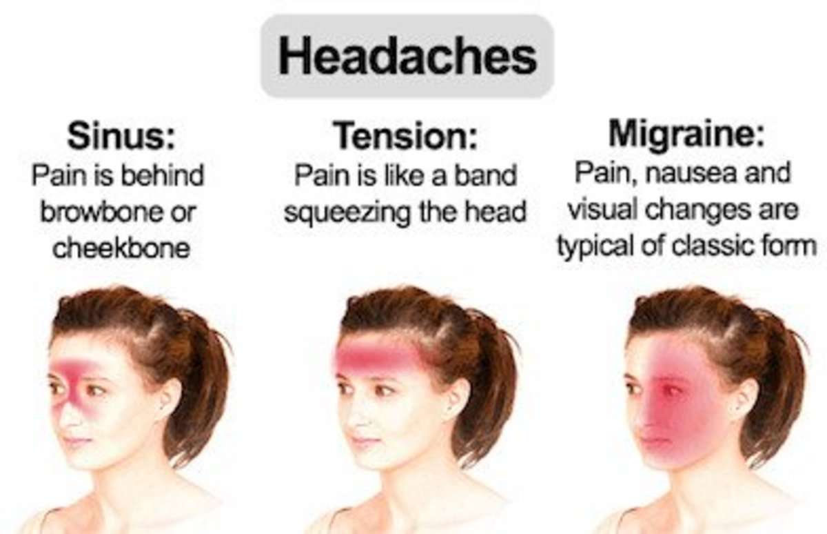 Headache in back of head