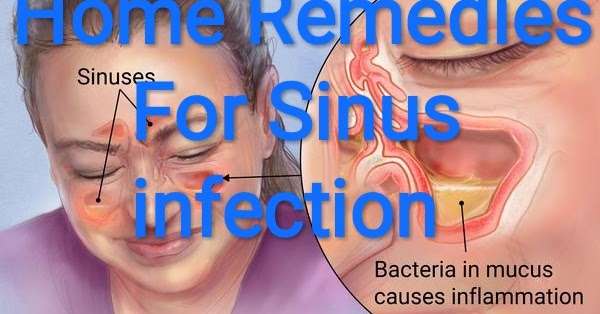 Healthcare &  Health solution: home remedies for sinus ...