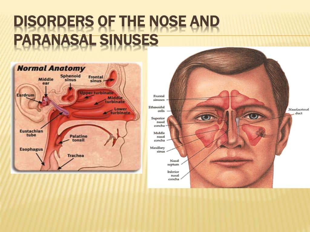 Hearing Loss Treated With Prednisone Sinusitis Nose Blowing