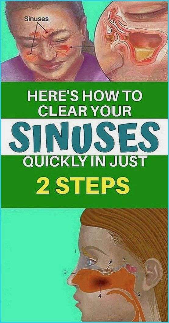 Hereâs How to Clear Your Sinuses Quickly In Just Two Steps