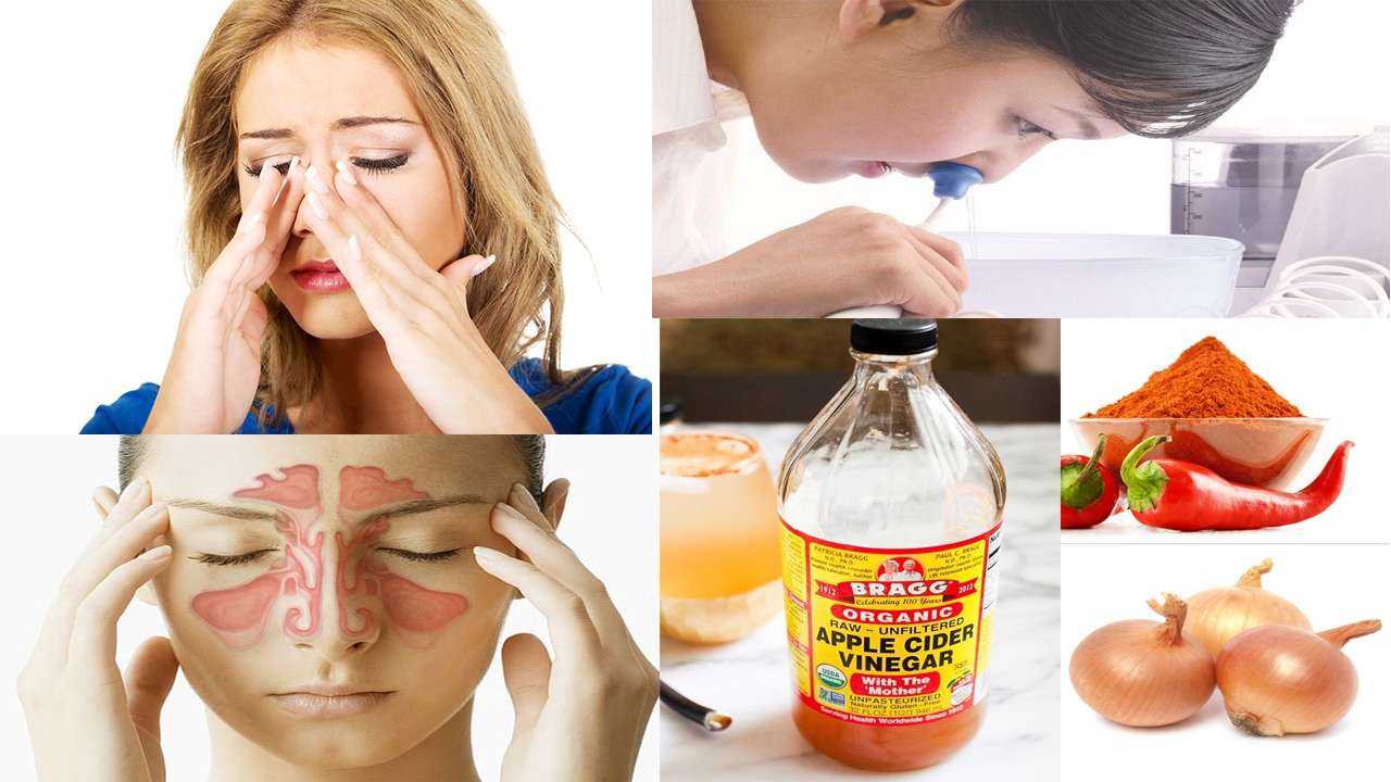 Home Remedies For Sinus / 13 Best Home Remedies for Sinus ...