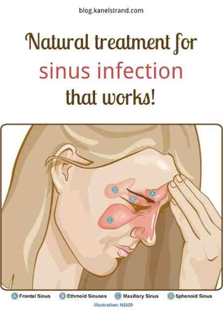 Home Remedies for Sinus Infections to Treat Naturally Fast