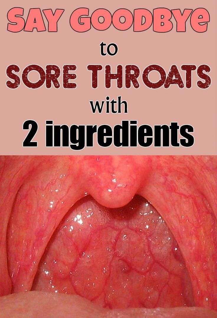 Home Remedies to counter Throat, Skin,Eye,Sinus Infections ...