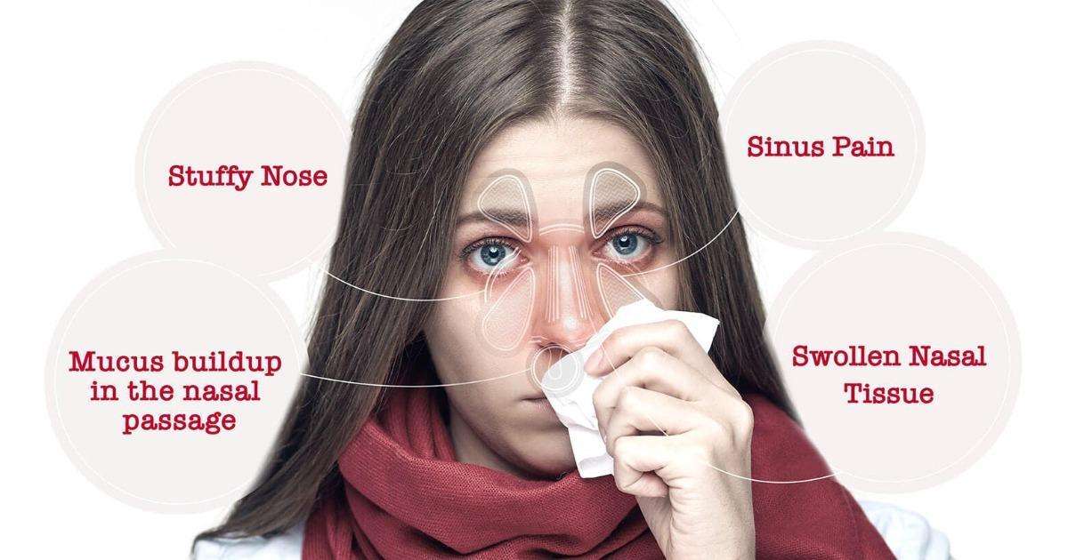 How can you help your child with sinus congestion?