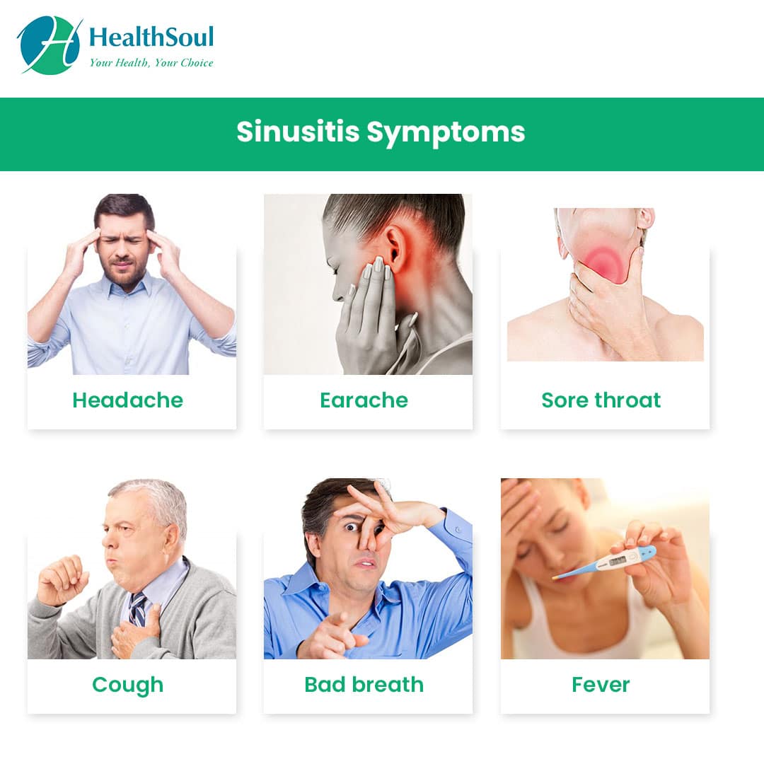 How Do They Diagnose A Sinus Infection