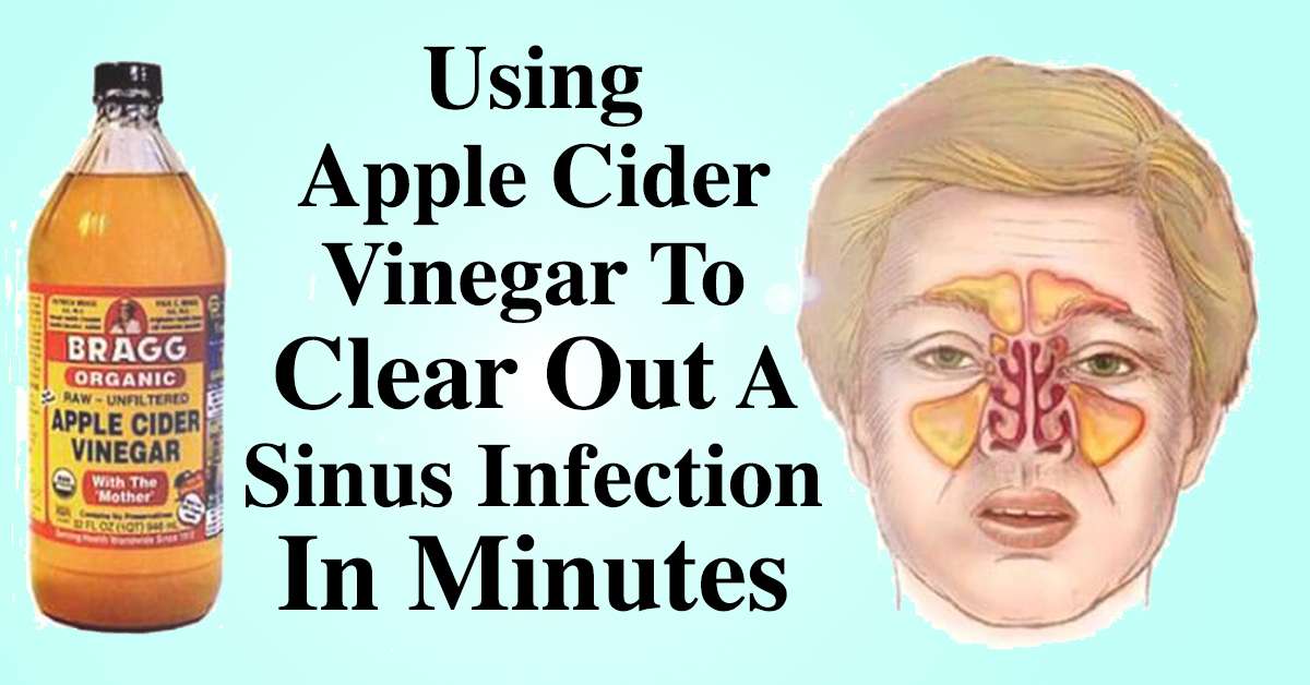 How To Clear Out A Sinus Infection Within Minutes With ...