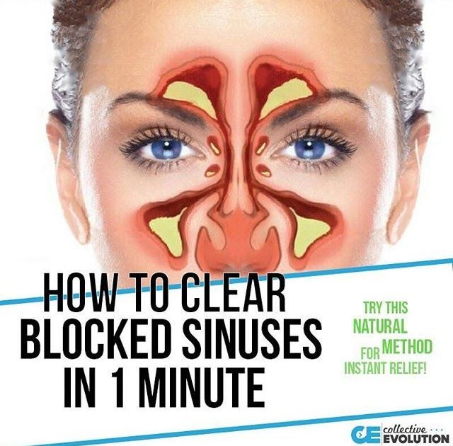 How To Clear Seriously Blocked Sinuses Naturally In 1 Minute We