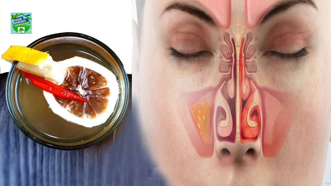 How To Get Rid Of Sinus Infection In No Time!