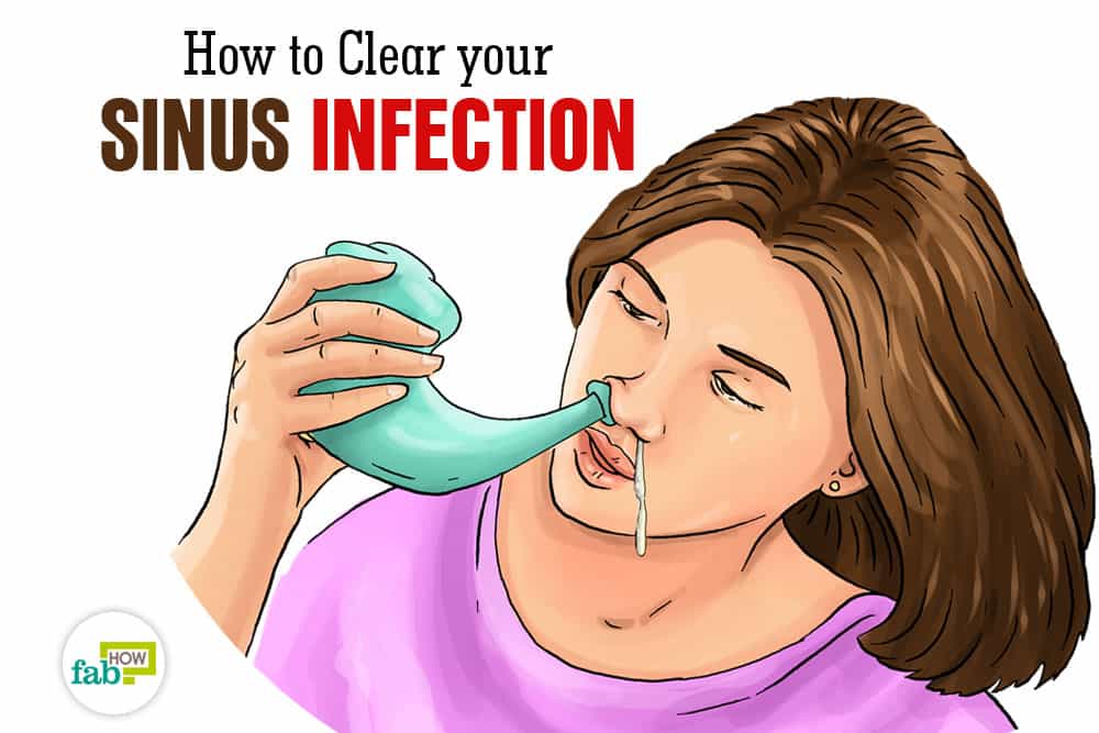 How to Get Rid of Sinus Infection with Home Remedies