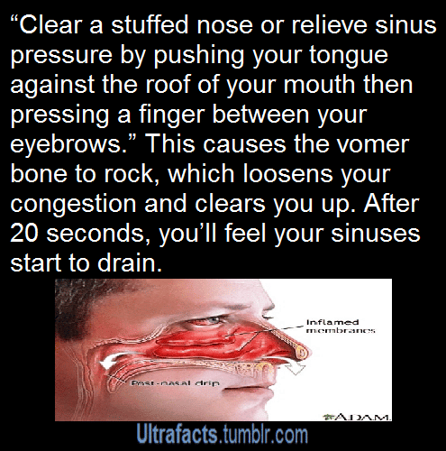 How To Get Rid Of Sinus Pressure Fast