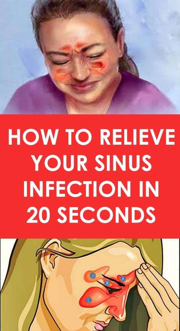 How To Relieve Your Sinus Infection In 20 Seconds ...