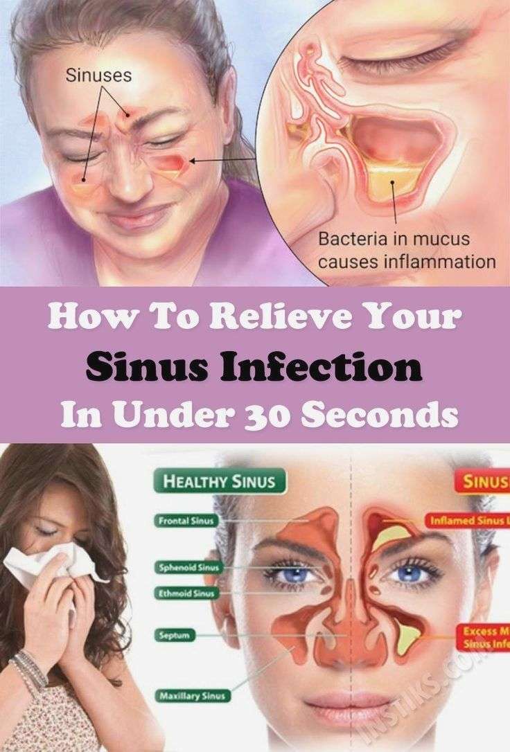 How To Relieve Your Sinus Infection In Under 30 Seconds ...