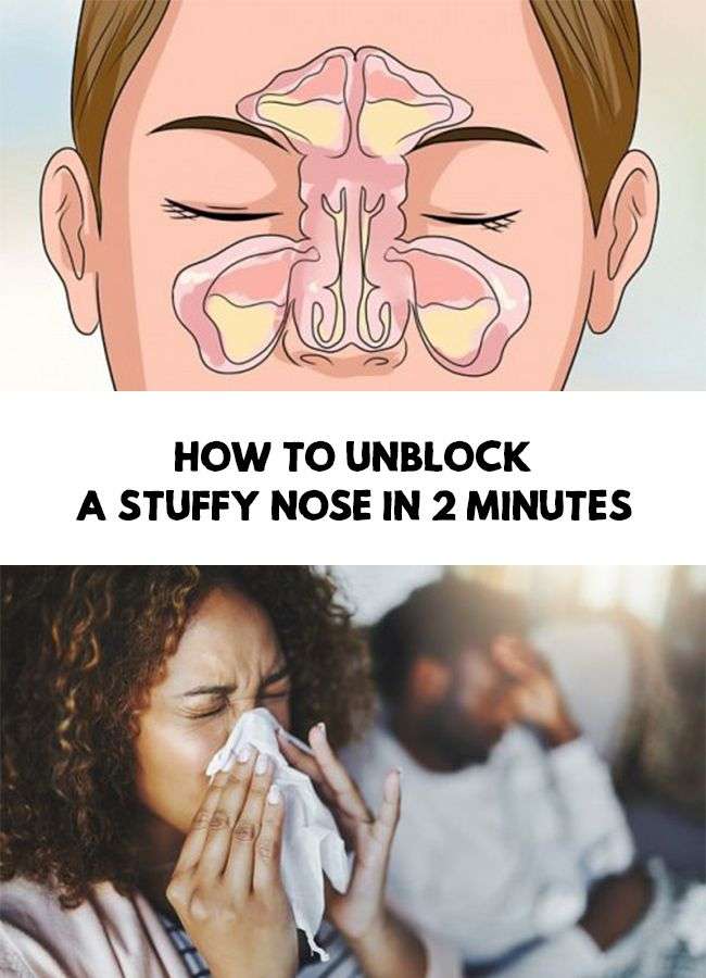 How to unblock a stuffy nose in 2 minutes