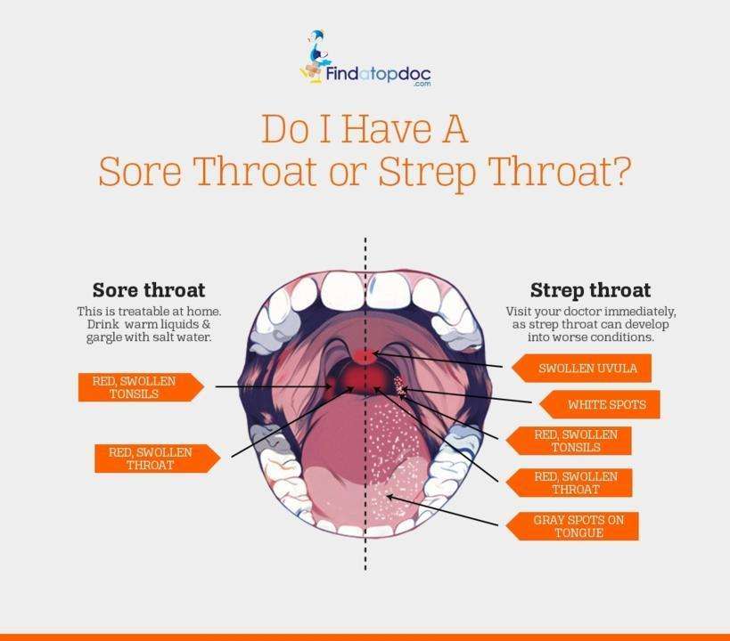 Is It a Sore Throat or Strep Throat? [Infographic]