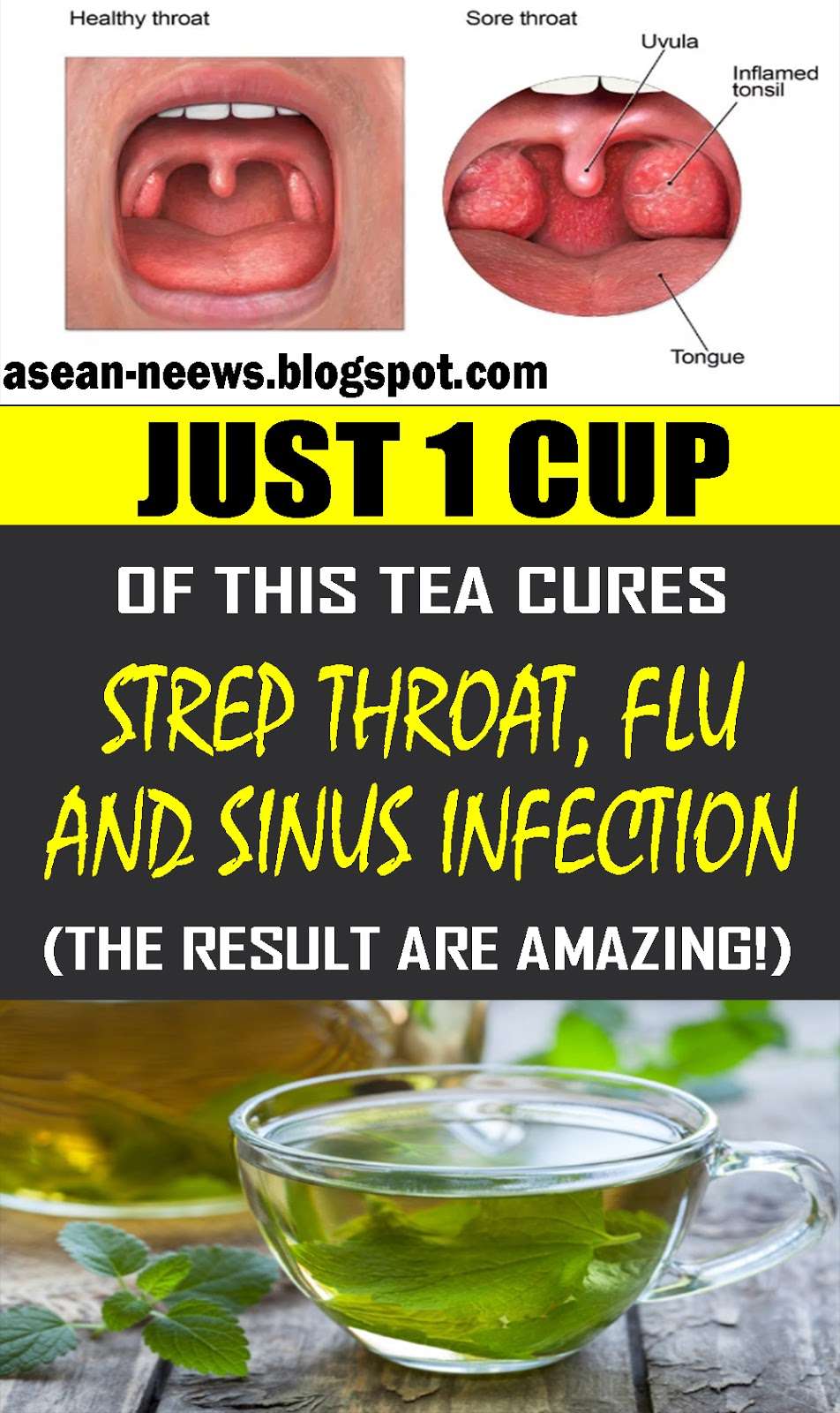 Just 1 Cup of This TEA Cures Strep Throat, Flu and Sinus Infections ...