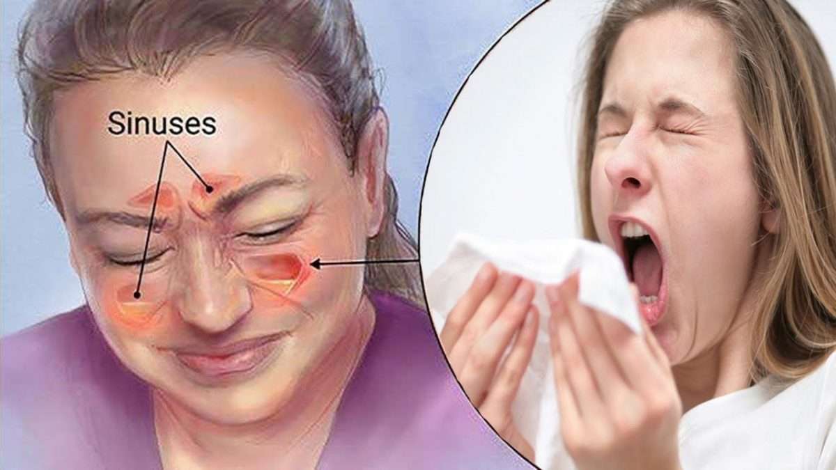 Kill A Sinus Infection In 20 Seconds with this Simple Method And ...