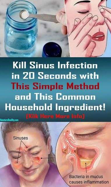 Kill Sinus Infection in 20 Seconds with This Simple Method and This ...