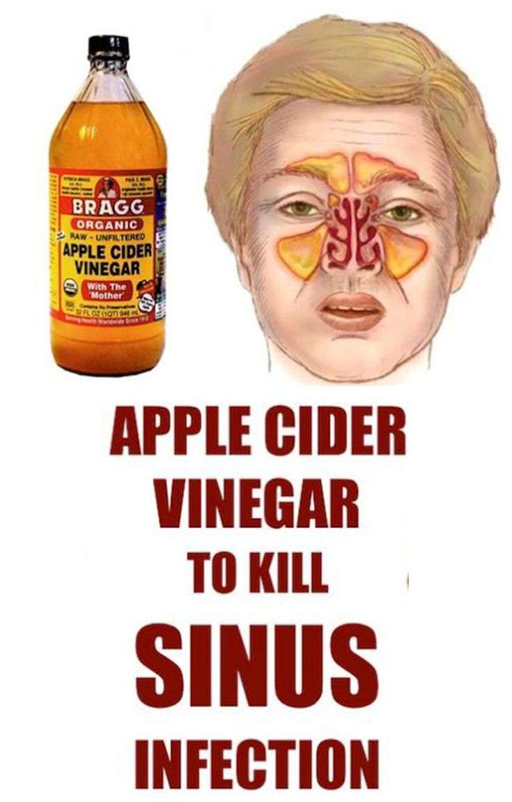 Kill Sinus Infection Within Minutes, With What You Have In Your Kitchen ...