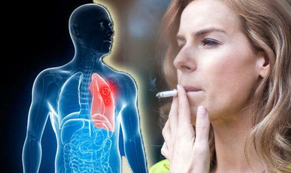 Lung cancer test: Nose swab could DETECT deadly disease in ...
