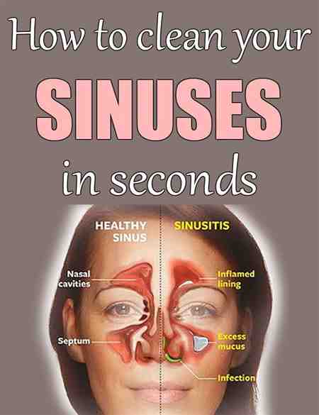 Middle Ear Cavity Mass Points Sinus Headache Pressure ...